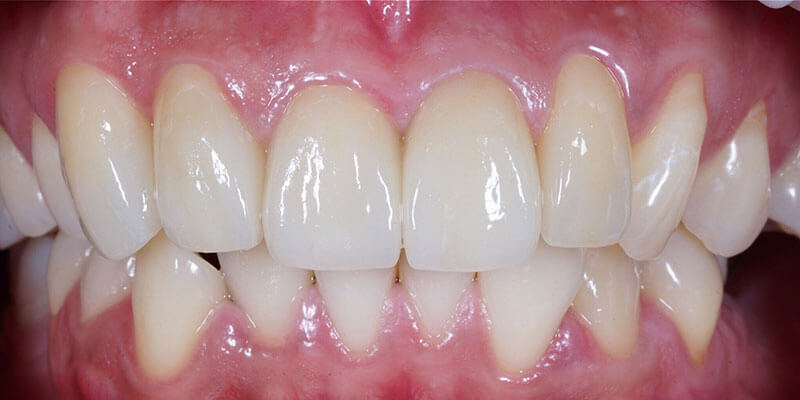 After image