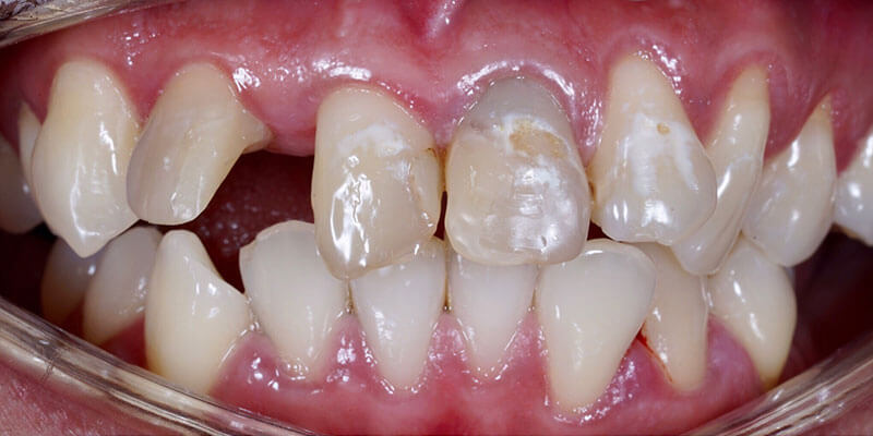 Before image