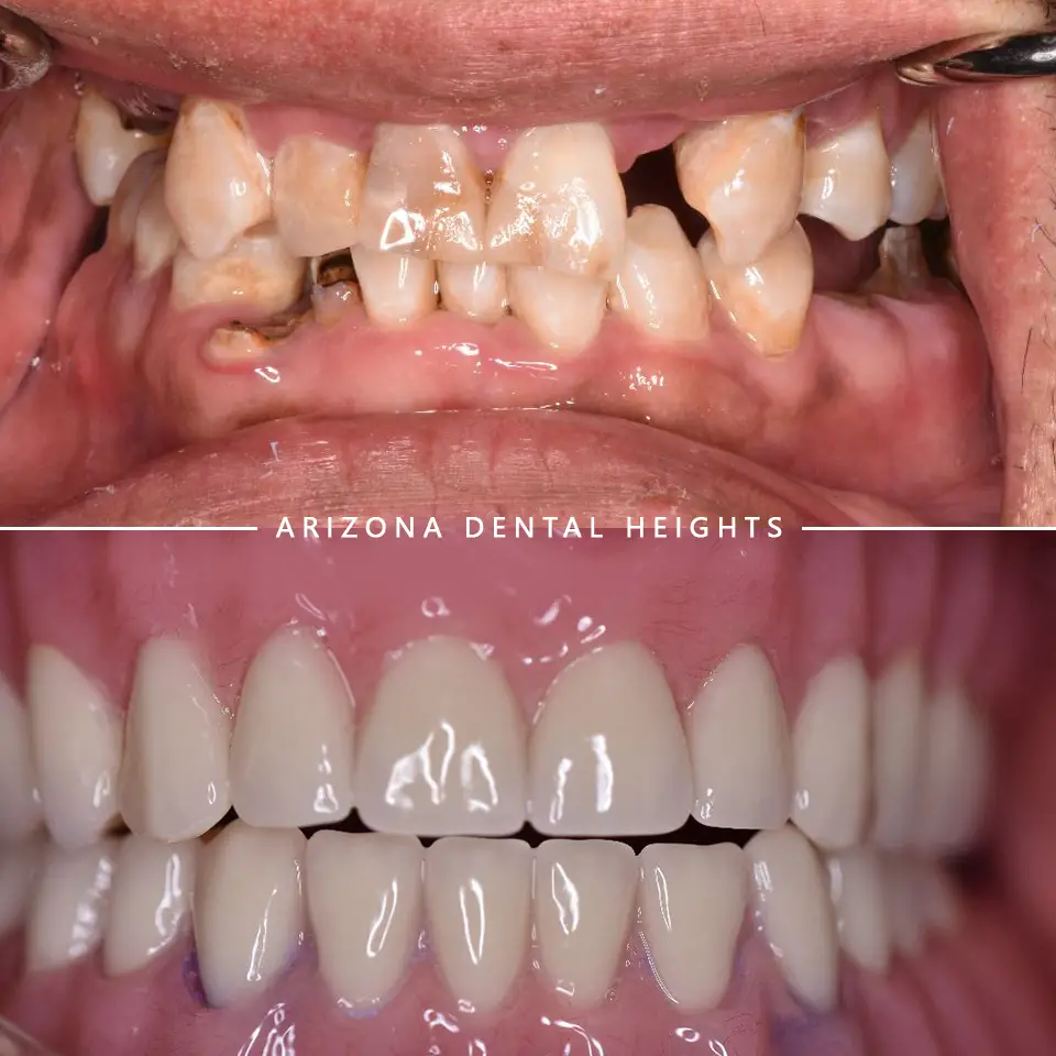 Top Dental Implants Near you